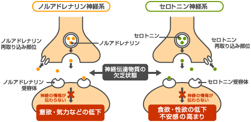 同梱不可 周産期メンタルヘルスケアの理論 産後うつ病発症メカニズムの 